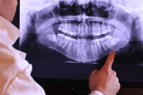Best Same-Day Emergency Dentist in Sparta, NC