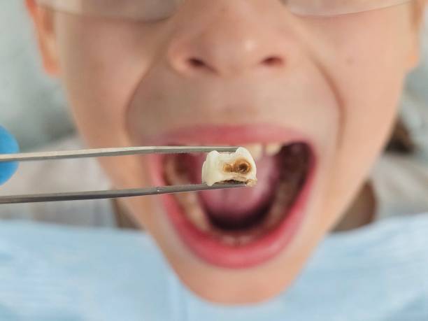 Best Pediatric Emergency Dentist in Sparta, NC