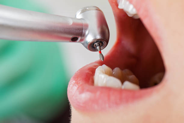 Best Emergency Dental Care for Trauma or Injury in Sparta, NC